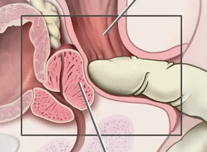 Prostate - liebeisstleben.de