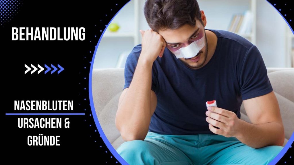 Nasenbluten