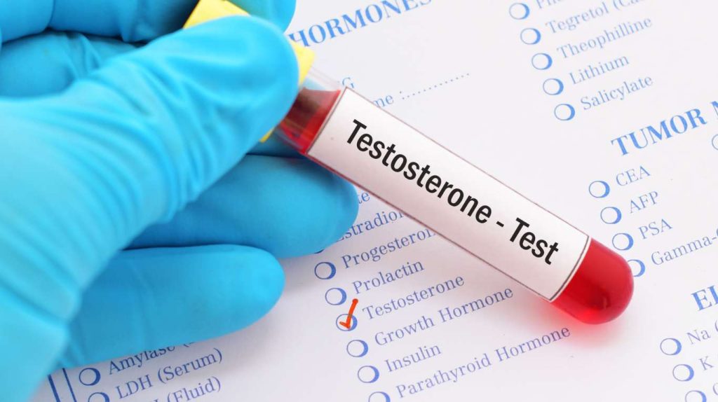 Warum solltest du einen Testosteron-Test machen?